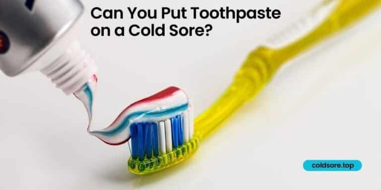 Can You Put Toothpaste on a Cold Sore?