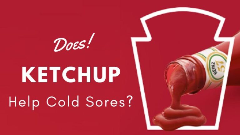 Does Ketchup Help Cold Sores?