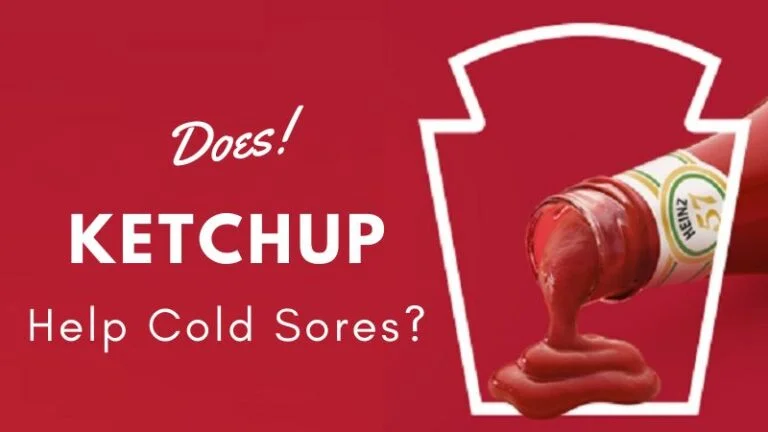 Does Ketchup Help Cold Sores?