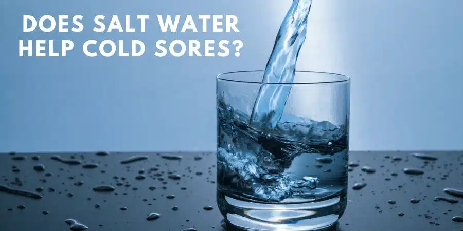 Does salt water help cold sores?